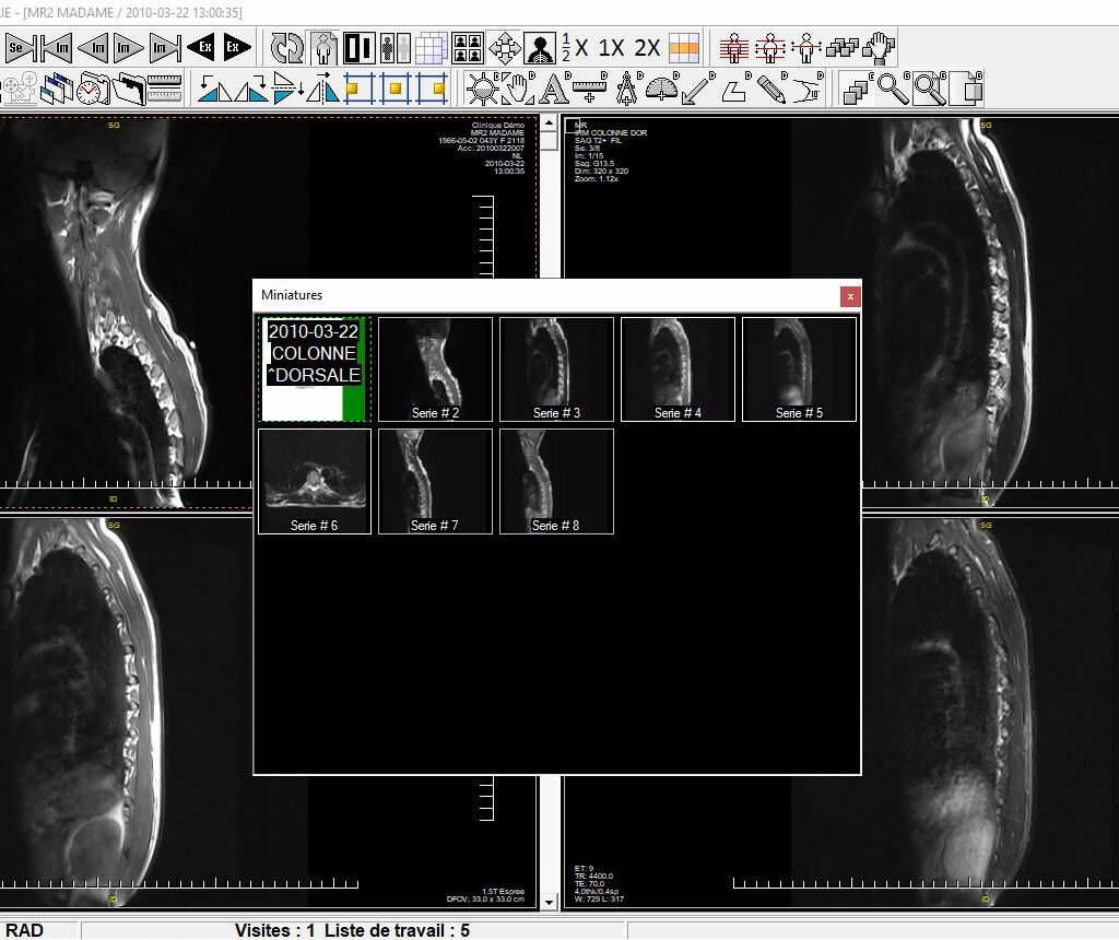 Softinfo RIS PACS logiciel imagerie médicale